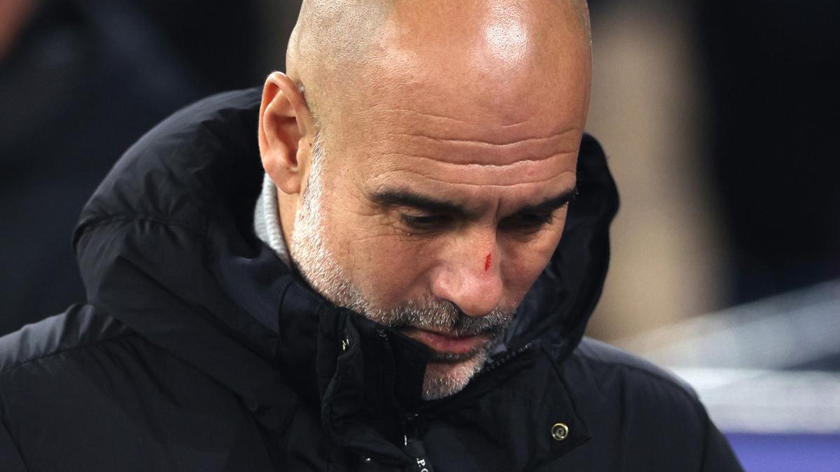 Man City : Pep Guardiola s’est encore griffé le visage